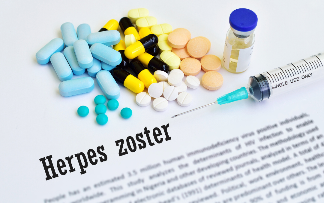 Há relação causal entre Herpes zoster e COVID-19?