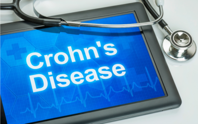 Doença de Crohn