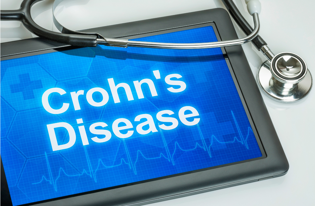 doença de Crohn