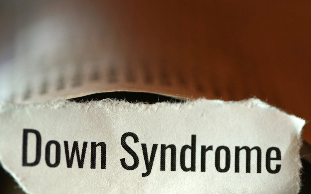 Descoberta tardia da Síndrome de Down