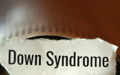 Descoberta tardia da Síndrome de Down